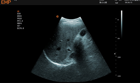 Adult cardiology