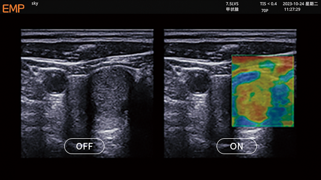 ELASTOGRAPHY