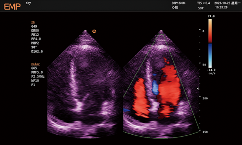 Cardiology