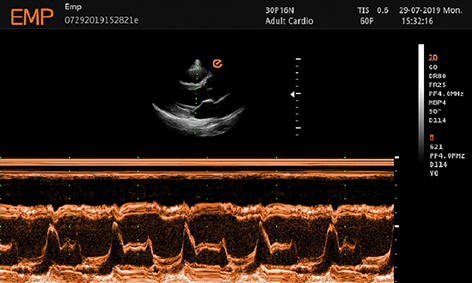 Adult Cardiology